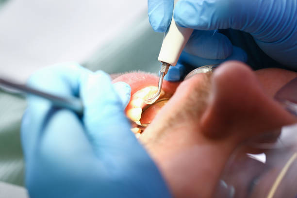 Best Weekend Emergency Dentist in Orland Hls, IL