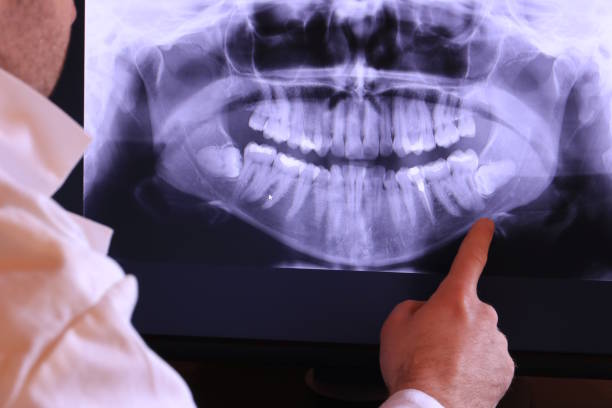 Best Emergency Dental Care for Broken or Chipped Teeth in Orland Hls, IL