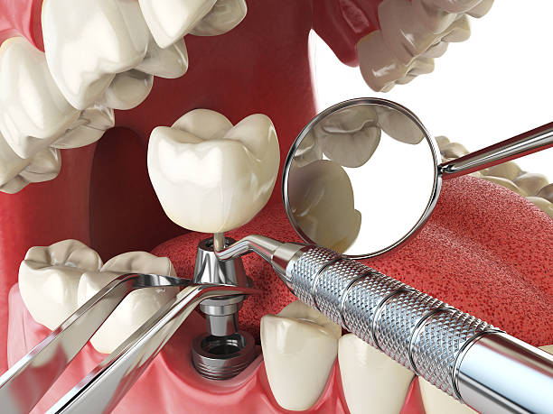 Best Emergency Orthodontic Services in Orland Hls, IL